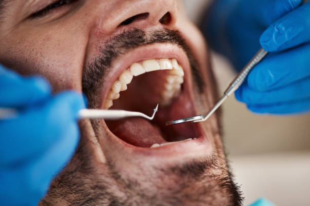 Best Broken or Chipped Tooth Repair in Sudan, TX